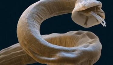 Parassita Ascaris nel corpo umano