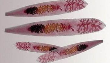 Parassiti dell'Opisthorchis nel corpo umano
