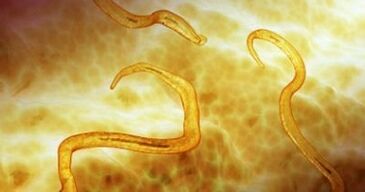 Parassiti ossiuri nel corpo umano