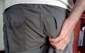 Prurito nell'ano come sintomo della presenza di parassiti
