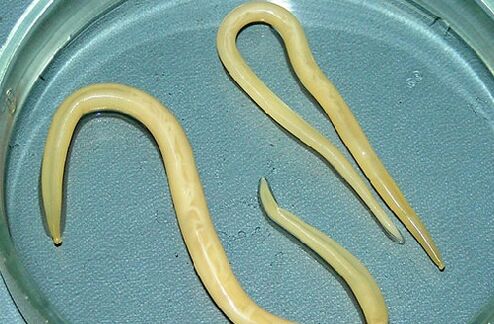Nematodi dal corpo di un bambino
