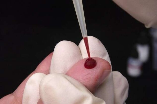 Prelevare il sangue per l'analisi dei parassiti
