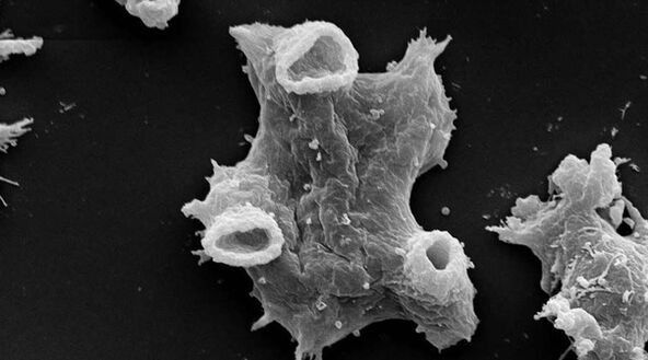 La Negleria fowlera è un parassita unicellulare pericoloso per la vita umana. 