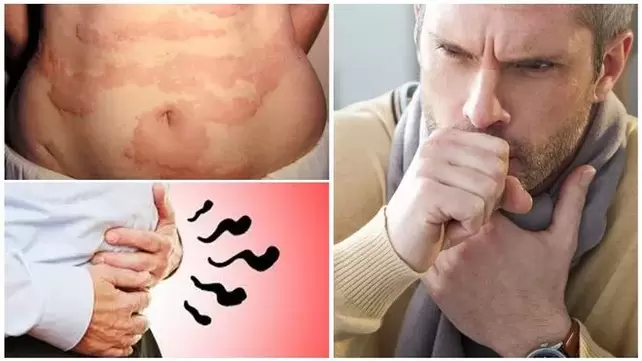 Allergie, tosse e gas sono segni di danni al corpo da parte di vermi